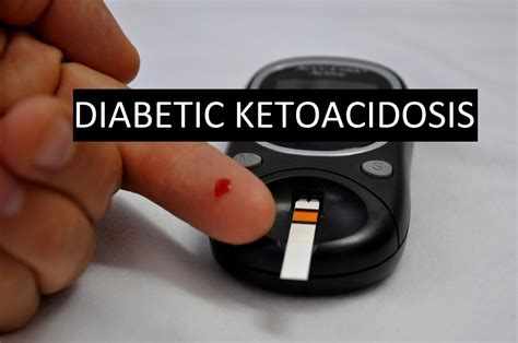 MBBS DOCTORS: DIABETIC KETOACIDOSIS