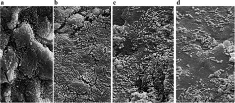 Scanning electron micrograph (3000× magnification) of Streptococcus... | Download Scientific Diagram