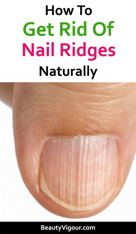 How To Get Rid Of Nail Ridges | Nail ridges, Nail health signs, Nail health