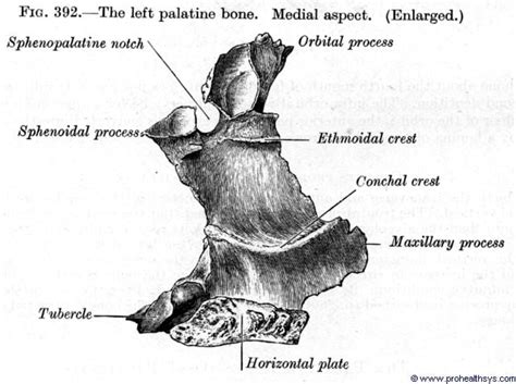 Palatine Bone - Prohealthsys