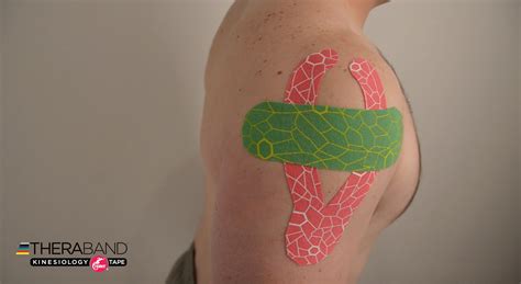 Kinesiology Taping for Shoulder Support (Option 1) - Performance Health Academy