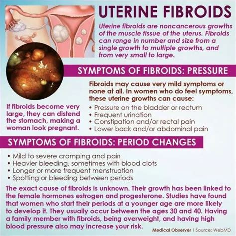 Symptoms Uterine Fibroids Symptoms, Uterine Fibroids Treatment, Fibroid Uterus, Fibroid Tumors ...