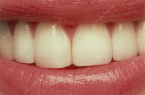 Close-up of a woman's mouth showing healthy teeth - Stock Image - P486/0043 - Science Photo Library