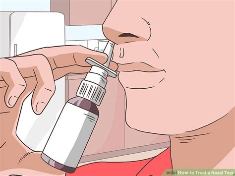 3 Ways to Treat a Nasal Tear - wikiHow