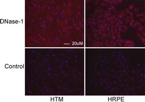 Effect of DNase I inhibitor on transfection efficiency. DNAse inhibitor ...