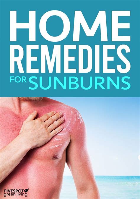 Home Remedies for Sunburns in 2020 | Home remedies for sunburn, Sunburn remedies, What's good ...