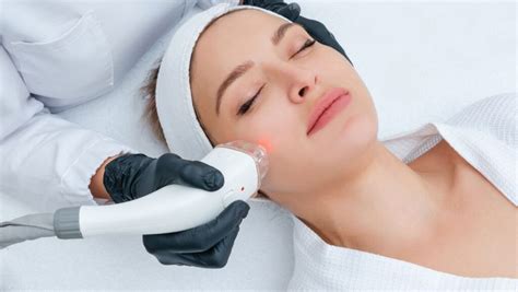 Benefits of a Sciton Halo Laser Treatment