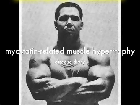 myostatin-related muscle hypertrophy by cjoymetzger