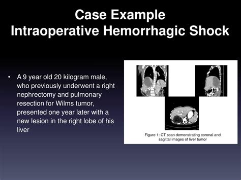 PPT - Traumatic Hemorrhagic Shock and Massive Transfusion Protocols in ...