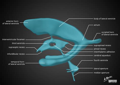 Brain ventricle anatomy diagram | Image | Radiopaedia.org