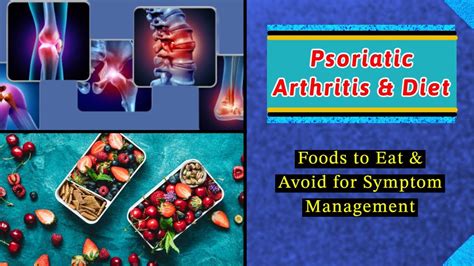 Psoriatic Arthritis & Diet: Foods to Eat and Avoid I Anti-Psoriasis ...