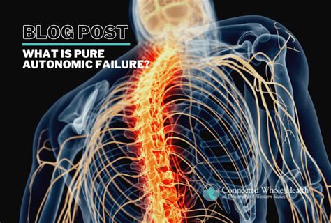 What is Pure Autonomic Failure? - UWS Connected Whole Health - UWS ...