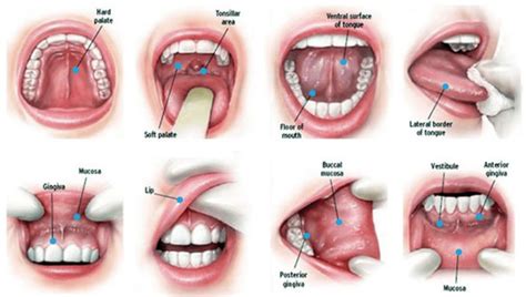 Oral Cancer Screening Exam Los Angeles | LA Periodontal Experts