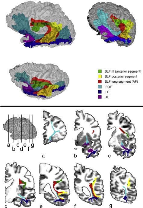 Registration of the reconstructed tracts into ex vivo MRI space. Top ...