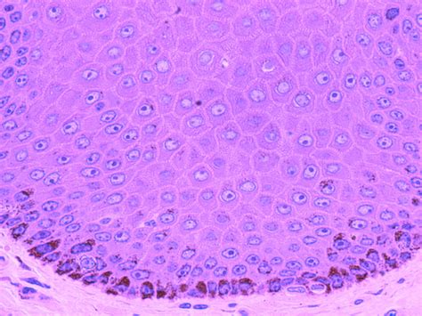 Stratum Basale and Stratum Spinosum