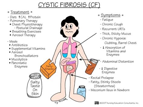 Cystic Fibrosis: Care Considerations of CF Patient