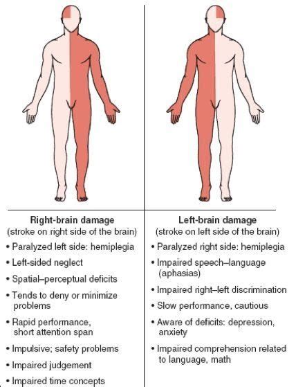 Cerebrovascular Accident (CVA) Right vs. Left Damage - Nurses Tips | Nursing school, Nurse