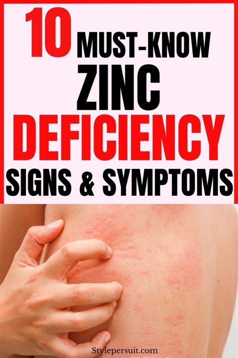 10 Zinc Deficiency Symptoms You Need to Know – StylePersuit