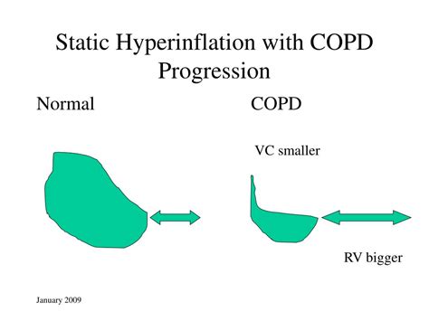 PPT - Pulmonary Function Testing Clinical Physiology PowerPoint Presentation - ID:316039