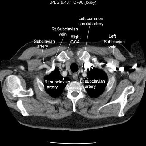 Arteries (With images) | Radiology imaging, Radiology student, Medical anatomy