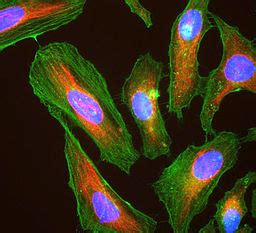 What are HeLa Cells? - Importance, Medical Breakthroughs, Microscopy