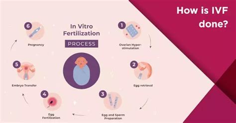 IVF Process: A Detailed Overview of the IVF Procedure | Nova IVF Fertility