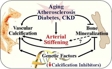 Arterial Stiffness | Arteriosclerosis, Thrombosis, and Vascular Biology