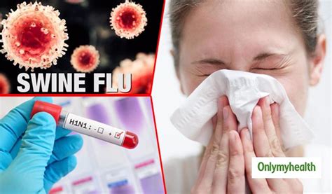 Swine Flu: Causes, Symptoms and More | OnlyMyHealth