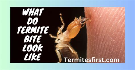 What Do Termite Bites Look Like? Symptoms & Treatment