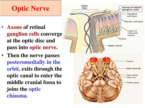 PPT - Cranial nerves II,III, IV,VI and Visual Pathway PowerPoint ...