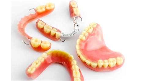 What to Expect from Your Partial Denture | Chagrin Falls OH