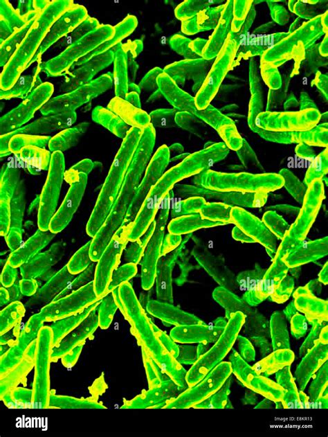 Mycobacterium tuberculosis bacteria fotografías e imágenes de alta ...