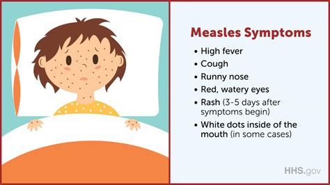 Measles: Signs and Symptoms - Commwellhealth.org