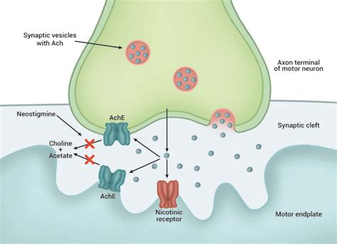 Reversal of Neuromuscular Blockade: Neostigmine - OpenAnesthesia