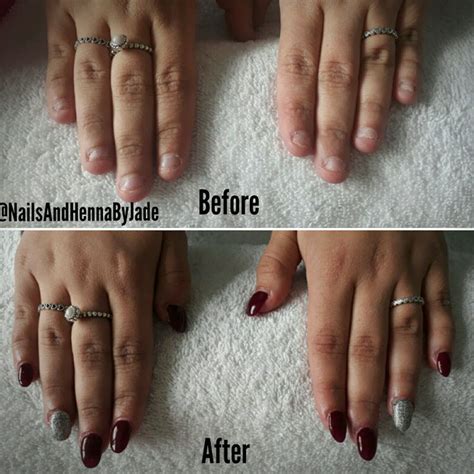 Before and after bitten nails @NailsAndHennaByJade | Nail fungus cure, Nail fungus remedy ...