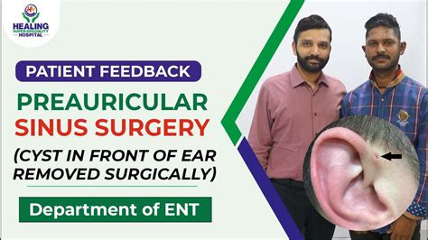 Preauricular Sinus Surgery | Ear Cyst Removed Surgically | Dept. of ENT Healing Hospital ...