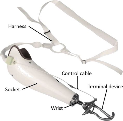 A typical body-powered upper limb prosthesis. | Download Scientific Diagram