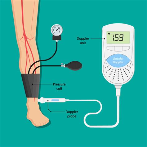 Automatic Leg Dopplers | The Academy of Research and Improvement