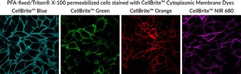 Tech Tip: Combining Lipophilic Membrane Dyes with Immunofluorescence - Biotium