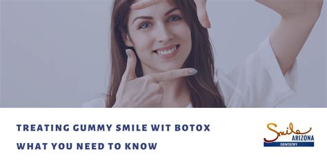 Treating Gummy Smile with Botox: What You Need to Know