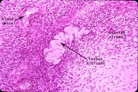 Corpus Albicans Histology