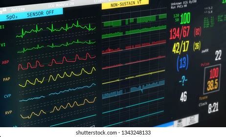 Icu Monitor Photos and Images & Pictures | Shutterstock