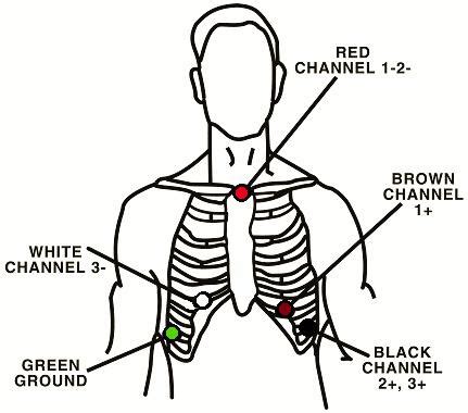 HOW TO - Prepare a Patient for a Holter Test