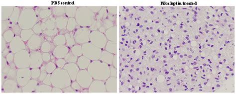 Histomorphology of white adipose tissue from pika leptin-treated and... | Download Scientific ...