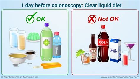 What is a colonoscopy and how do I prepare for it? in 2020 | Clear liquid diet, Colonoscopy ...