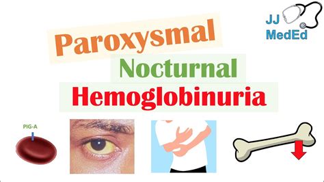 Paroxysmal Nocturnal Hemoglobinuria (PNH) | Causes & Pathogenesis, Symptoms, Diagnosis ...