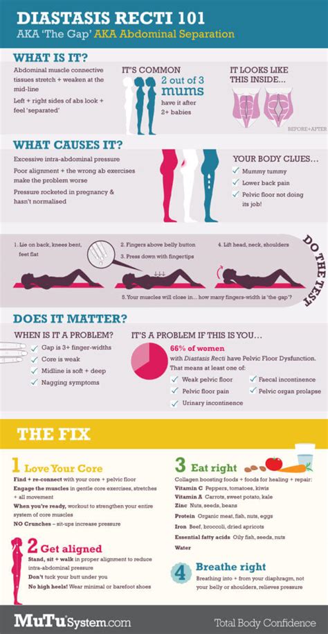 How To Heal Diastasis Recti - Lindywell