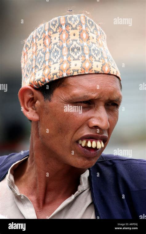 "Man with huge teeth Kathmandu Stock Photo - Alamy