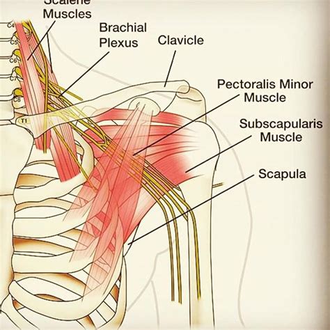 Brachial plexus anatomy from our partnership ... | Brachial, Plexus ...