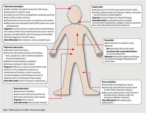 Tuberculosis in Children in Developing Countries - microbewiki